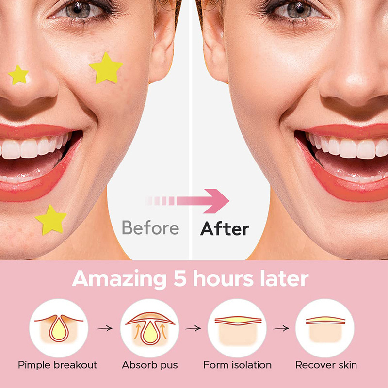 600 unids/set estrella parche  - Beauty Makeup Remover reseña y precio