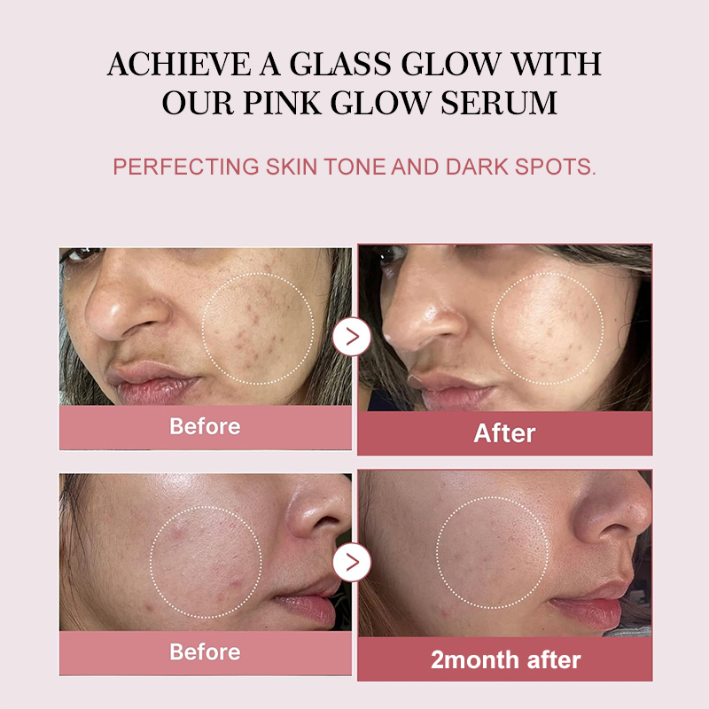 Suero Facial con Colágeno y Pé - Beauty Makeup Korean reseña y precio